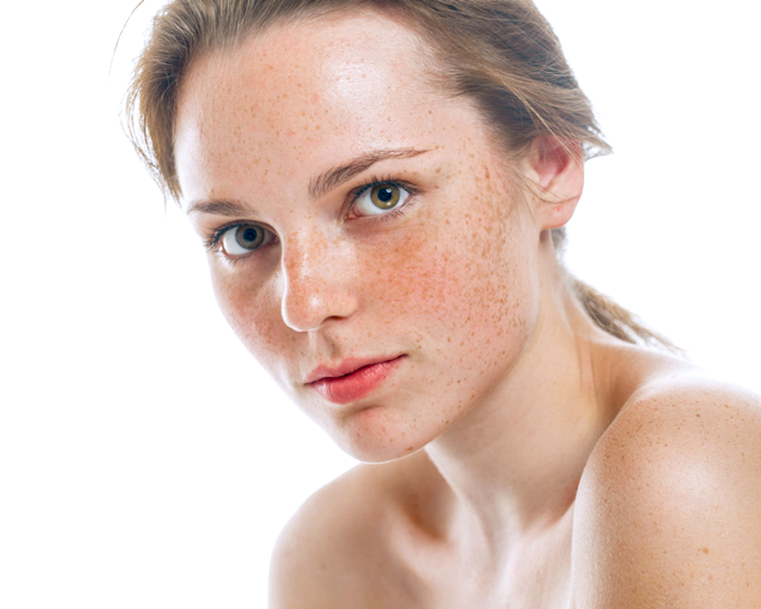 Causes and types of pigmentation
